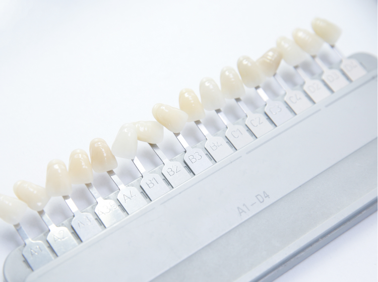 ホワイトニング